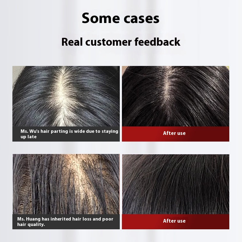 LYVA Red Light Scalp Comb usage