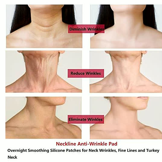LYVA Neck Anti-Wrinkle Pad results grid